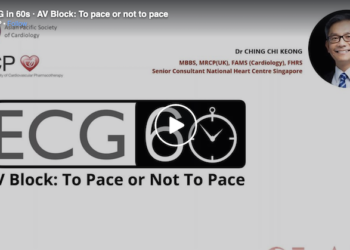 AV Block: To Pace or Not To Pace